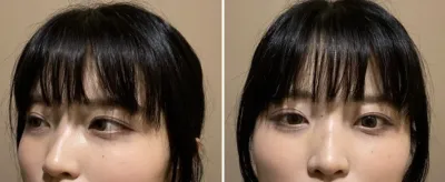 [Mũi] Mũi thon gọn - Mũi