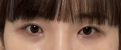 [Mắt] Bboppi Bbippo - Mắt