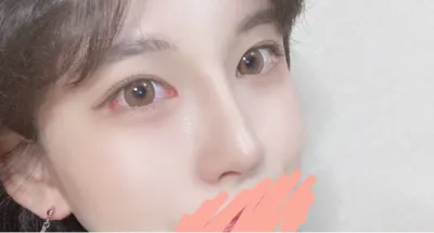 [Mũi] Thích Vui Chơi Nhất - Mắt, Mũi, Nâng Trán