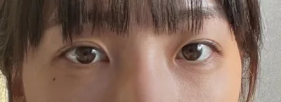 [Mắt] Ruby Lung - Mắt