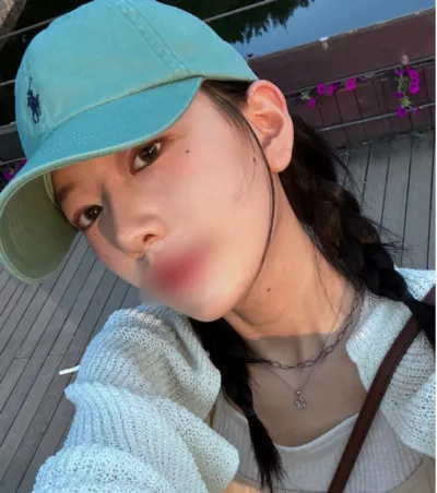 [Mũi] Mangnanyong - Mũi