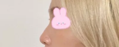 [Mũi] Vancouver - Mũi