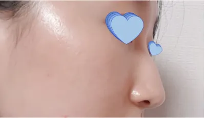 [Mũi] Phù thủy đáng sợ - Mũi