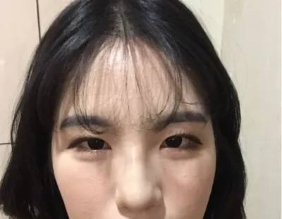 [Mắt] Chocochip ẩm ướt - Mắt, mũi