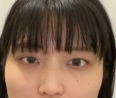 [Mũi] Byeolika-bi - Mắt, Mũi