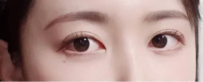 [Mắt] Lion Chunsik - Mắt