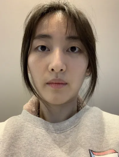 [Mắt] Park Myung-soo - Bấm mí, Filler