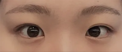 [Mắt] Minglulu - Mắt