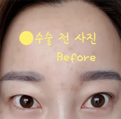 [Mắt] American Shorthair - Mắt