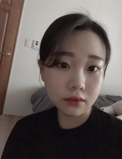 [Gọt mặt] Nya Na Nya Na Nyaang - Gò má, Góc hàm, Cằm