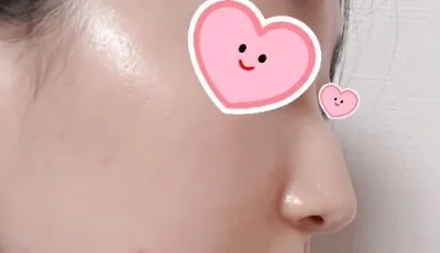 [Mũi] Peekom - Mũi