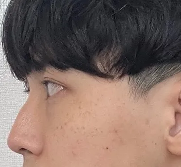 [Mũi] Hip Hinge - Mũi