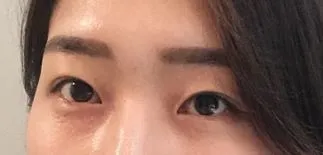 [Mắt] Dù sao thì - Mắt