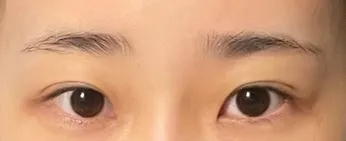 [Mắt] Pocari Sweat - Mắt