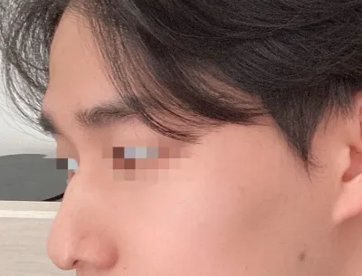 [Mũi] Kwan-i - Mũi