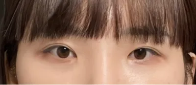 [Mắt] Daily Eye - Mắt