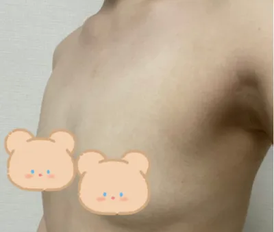 [Ngực] Roulala - Ngực