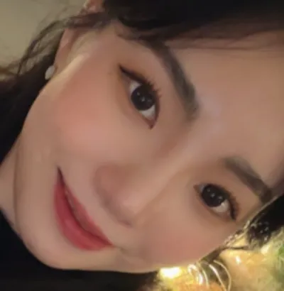 [Mũi] Monggeul Gureum - Mũi, Cấy Mỡ