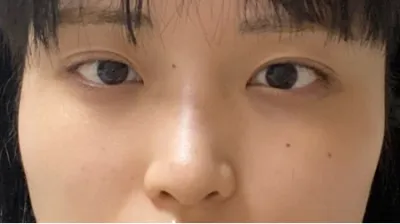 [Mũi] Toughkukik - Mắt, Mũi