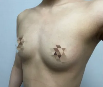 [Ngực] Búp bê - Ngực