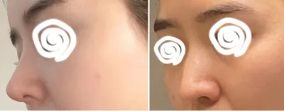 [Mũi] Kukudatzzu - Mũi