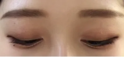 [Mắt] Cá chiên giòn - Mắt