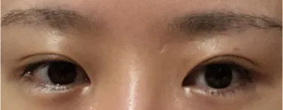 [Mắt] Jeong Sae-woo - Mắt