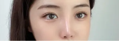 [Mắt] Mymelos - Mắt, mũi