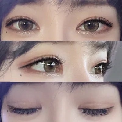 Đã 4 tháng kể từ khi mình phẫu thuật lại mắt.