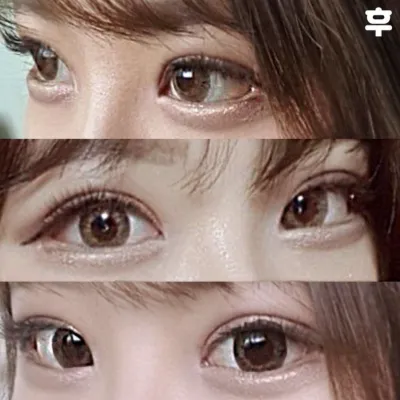 Đã 3 tuần kể từ khi mình phẫu thuật mắt rồi đó haha