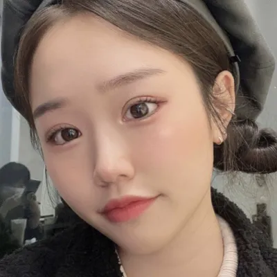 Đã 2 tháng kể từ khi mình phẫu thuật mắt ~