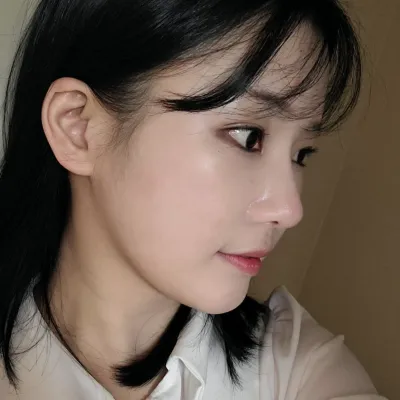 Đã được 2 tháng kể từ khi mình phẫu thuật lại mắt và mũi tại Bệnh viện thẩm mỹ Weavers