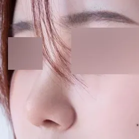 Mình rất khuyến khích nếu bạn lo lắng về chiếc mũi của mình ~