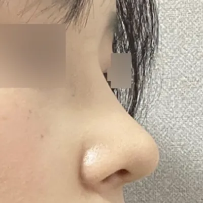 Mình rất hài lòng vì ca phẫu thuật đã diễn ra rất tốt!