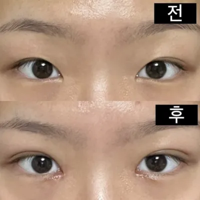 Tất cả ảnh trước/sau đều được chụp bằng camera thường!