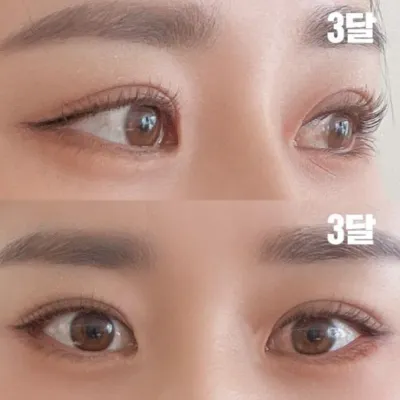 Họ đã phẫu thuật rất tốt theo phong cách mình muốn!!