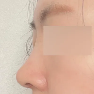 Mình trở nên xinh đẹp hơn rất nhiều nên mình tự tin hơn ngay cả khi không trang điểm