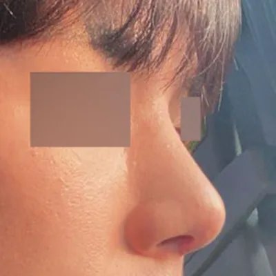 Mình đang mong đợi vì họ nói nó sẽ được duy trì thon gọn