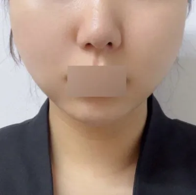 Nâng cơ bằng chỉ là một quyết định tuyệt vời