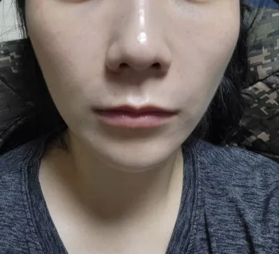 Xem tay nghề bác sĩ, mình nghĩ không cần phải lo lắng gì cả.