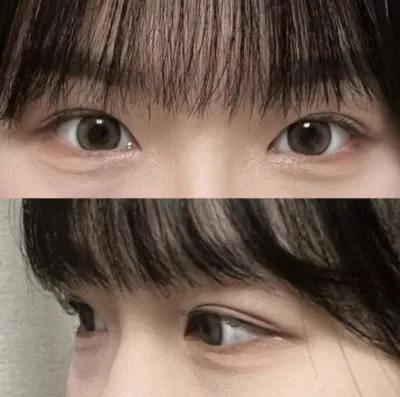 Mình đã quyết định phẫu thuật tại Weaver Plastic Surgery vì họ đã tư vấn cho mình rất kỹ càng!