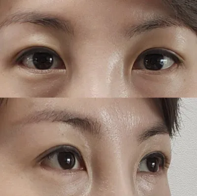 Nghĩ đến thôi đã thấy rất phấn khích! Mình nghĩ mình đã làm rất tốt khi phẫu thuật