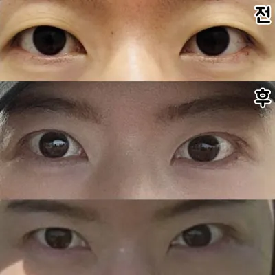 Bác sĩ làm cho mình rất đẹp nên mình rất hài lòng