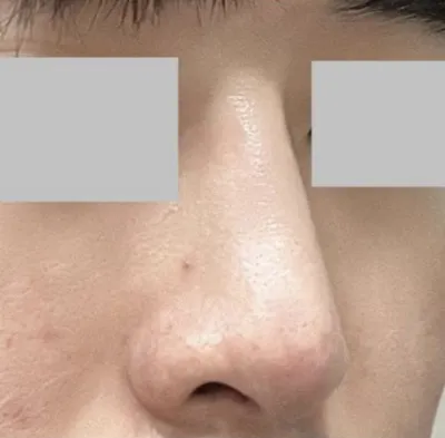 Mình muốn một vẻ ngoài tự nhiên và nó hoàn toàn phù hợp với mình