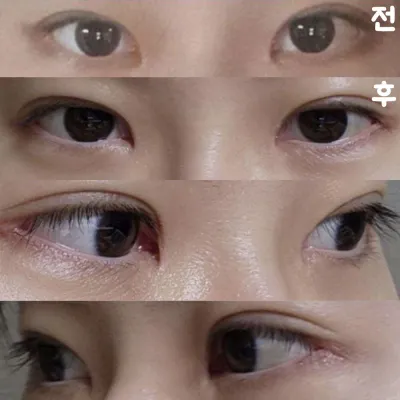 Mình rất hài lòng vì đôi mắt trông thoáng và dễ chịu hơn rất nhiều!