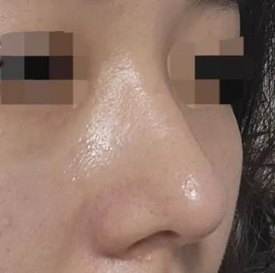 Mình đã rất đắn đo trước khi quyết định thực hiện, nhưng mình không hề thấy tiếc tiền và cảm thấy rất hạnh phúc!