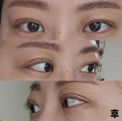 Mình nghĩ rằng mình đã làm rất tốt khi phẫu thuật