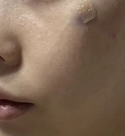 Cảm giác như những phần khiến mình bận tâm đã được cải thiện một cách tự nhiên!