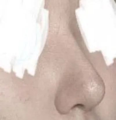 Mình đã được tặng một cuộc đời mới tuyệt vời nhất