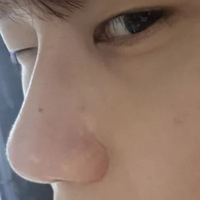 Mình nghĩ rằng mình đã làm tốt khi phẫu thuật. Cảm ơn bạn.